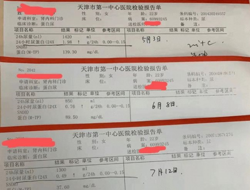 高熱量食物有哪些 吃多了易發(fā)胖又不利于健康